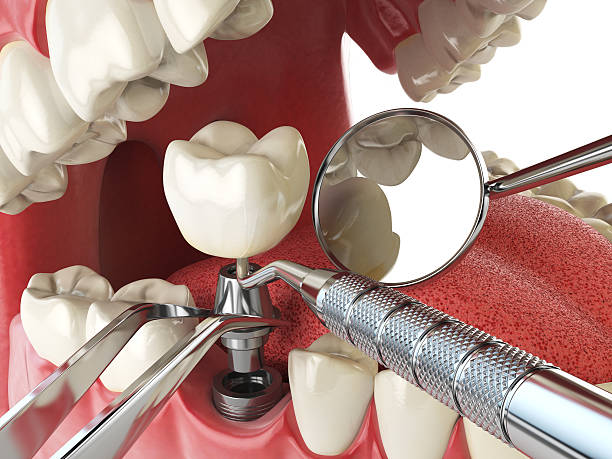 Best Weekend Emergency Dentist in Leakesville, MS
