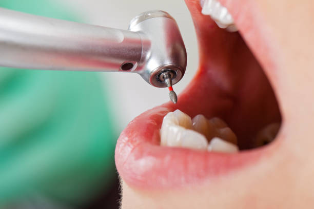 Best Pediatric Emergency Dentist in Leakesville, MS